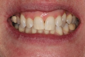 White teeth, fresh teeth, clean teeth