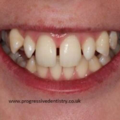 before abc dental treatment