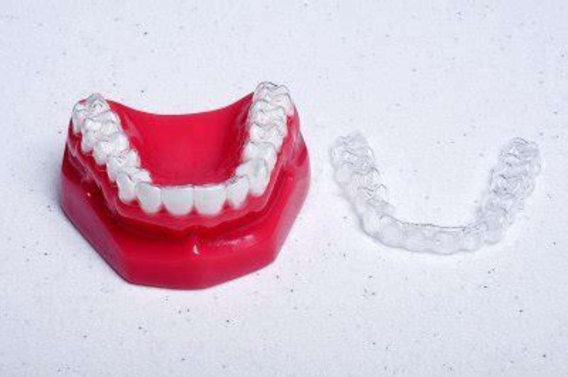 Progressive aligners