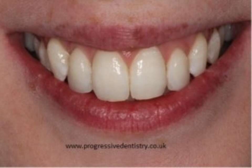 after abc dental treatment