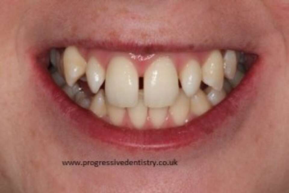 before abc dental treatment