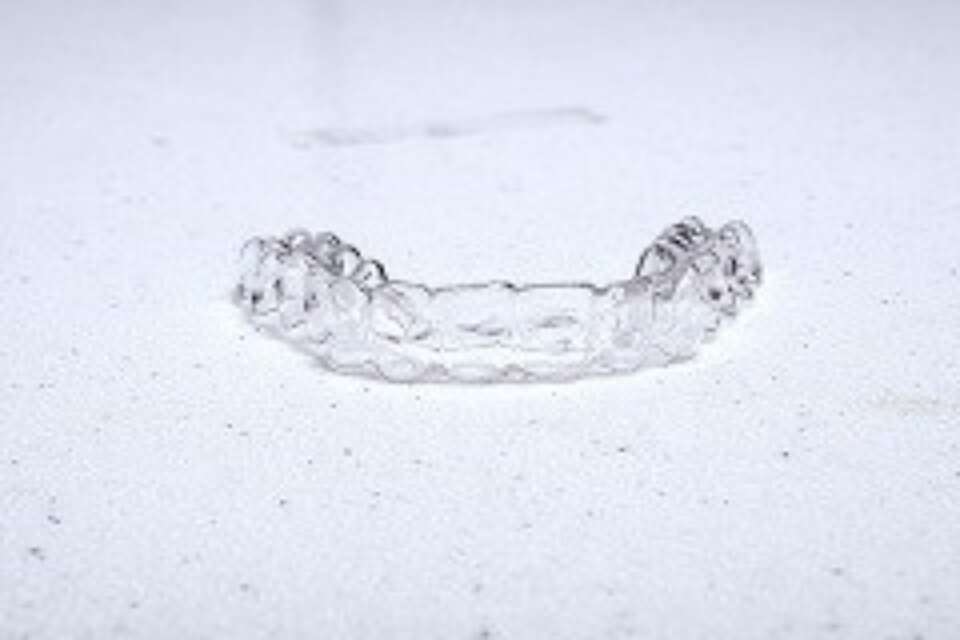 removable clear aligner