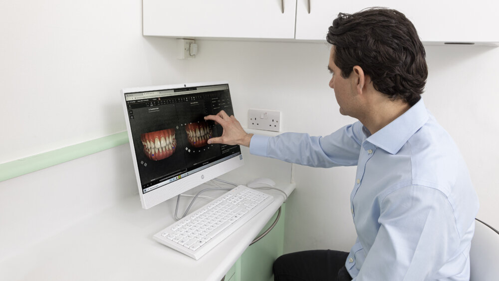 cosmetic dentistry in fulham, london