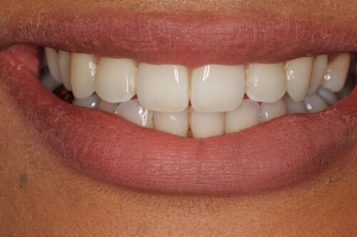 IMG 3313