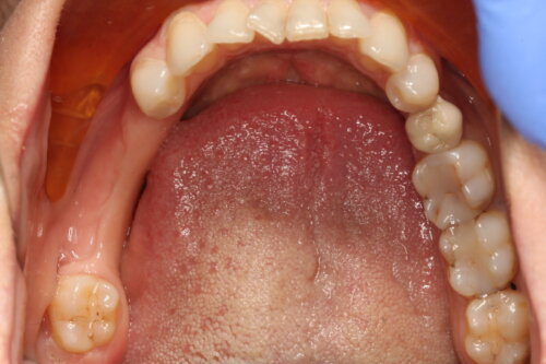 A birds eye view of mouth and teeth