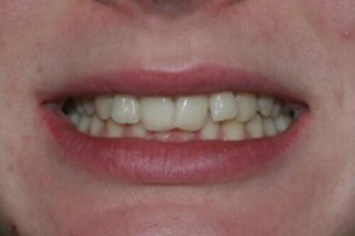 3crooked smile 2022 11 01 132632 tdpd