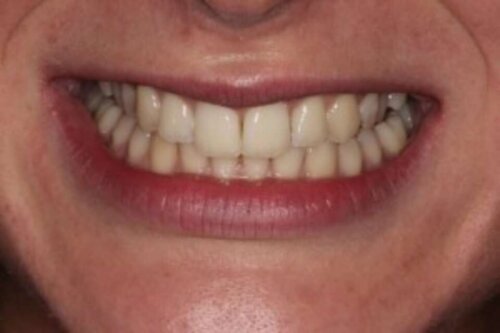 4beaming smile