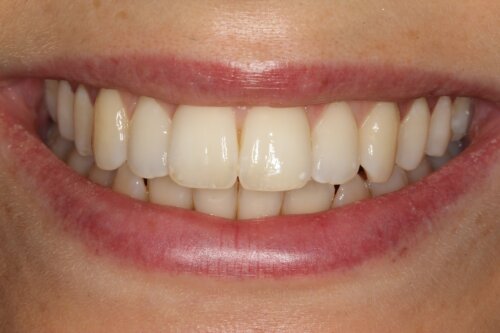 After