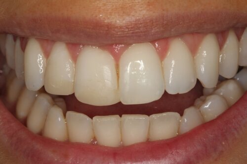 Before