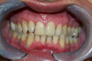 IMG 61081 300x200ff