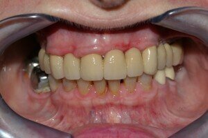 IMG 7540 300x200g