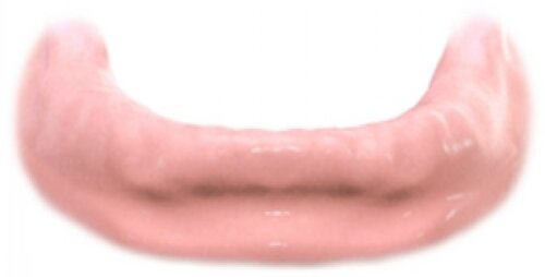 Removable Denture 1