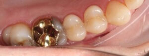 Crown IO