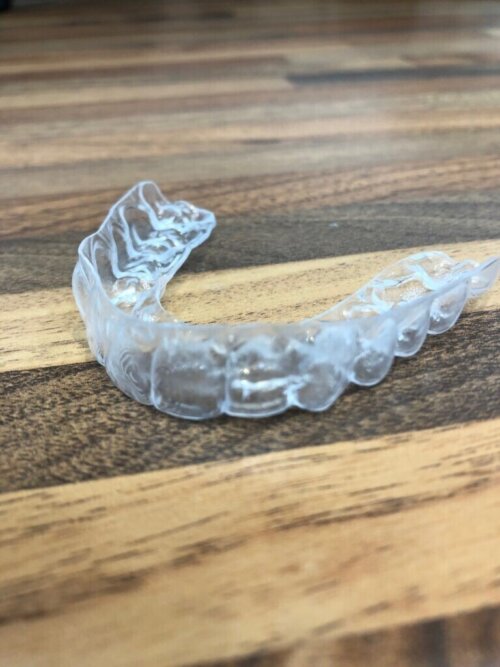 Removable essix retainer
